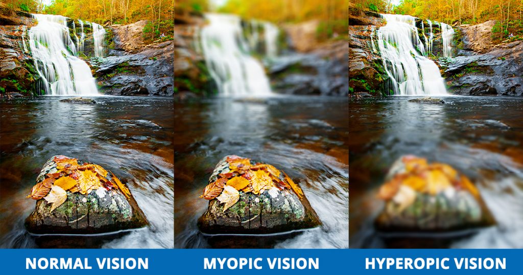 Refractive Errors Normal Vision Myopia Hyperopia Visual Simulation 1024x538 1 